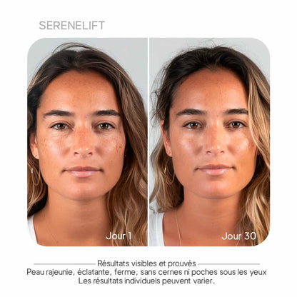 SereneLift - Thérapie LED curative