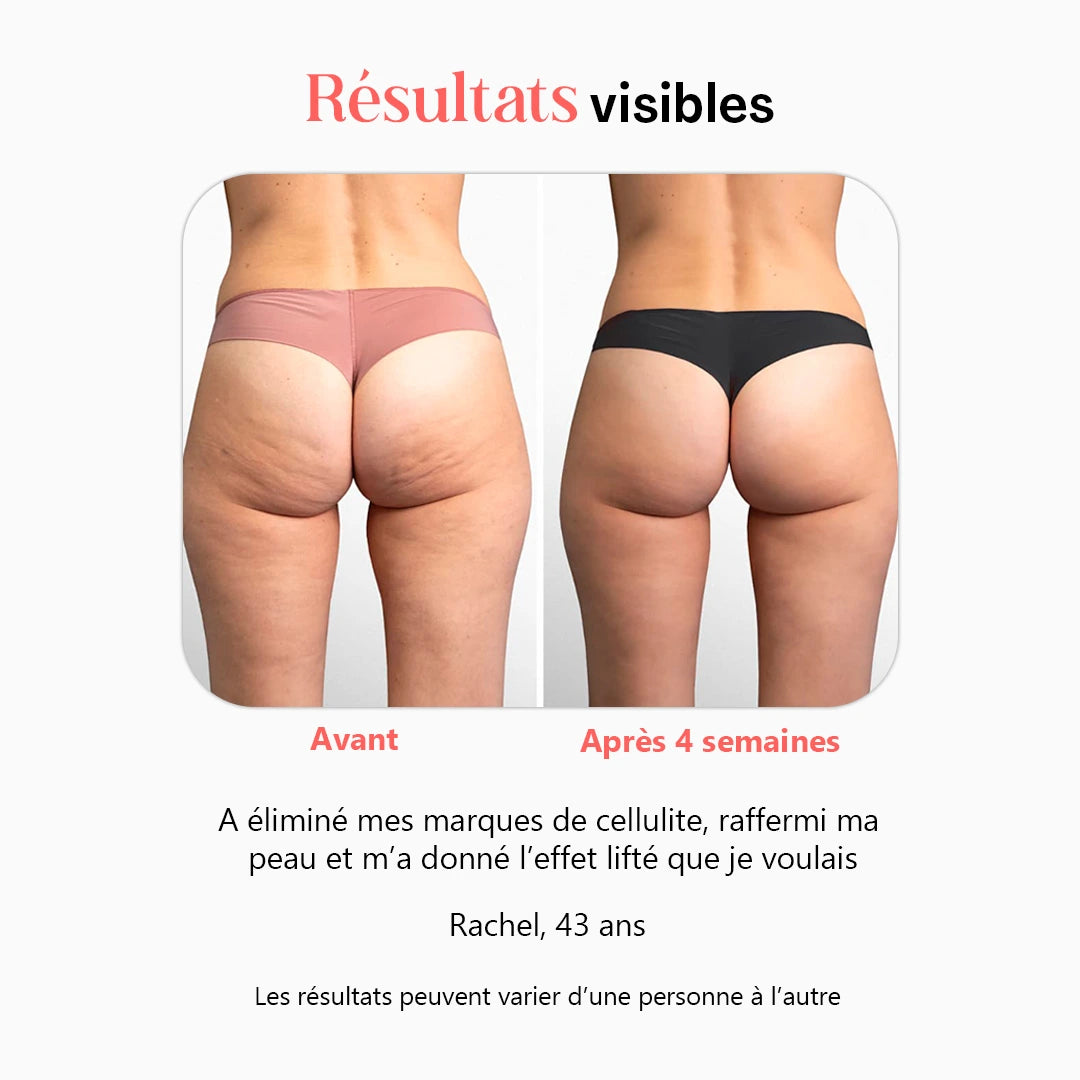 Deluxe Sculpt – Kit pour sculpter, tonifier et éliminer la cellulite