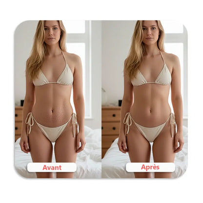 Deluxe Sculpt – Kit pour sculpter, tonifier et éliminer la cellulite